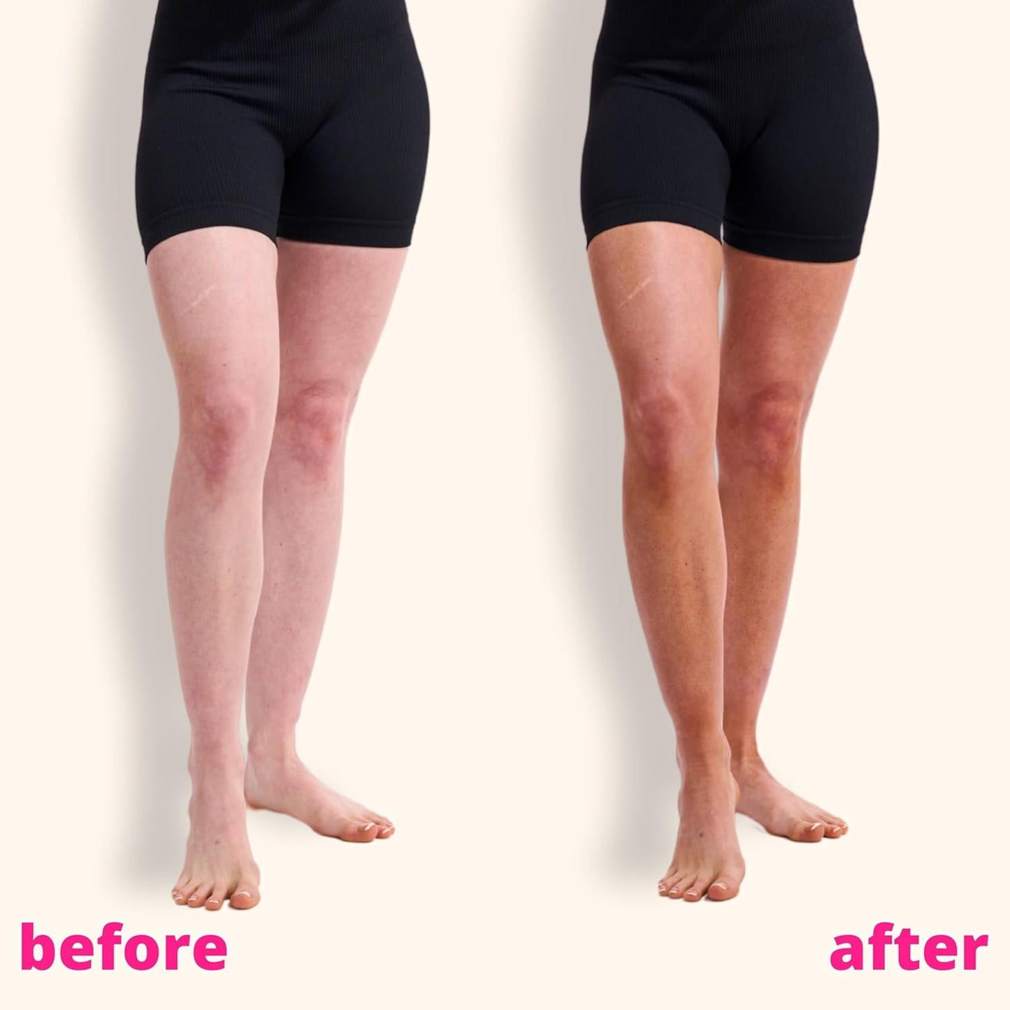 Skinny Tan Self-Tanning Mousse - Long-Lasting and Non-Drying Formula - Coconut and Vanilla Scent - Easy To Apply Luxurious, Foam Texture - Streak Free and Natural Looking Results - Medium - 5 oz