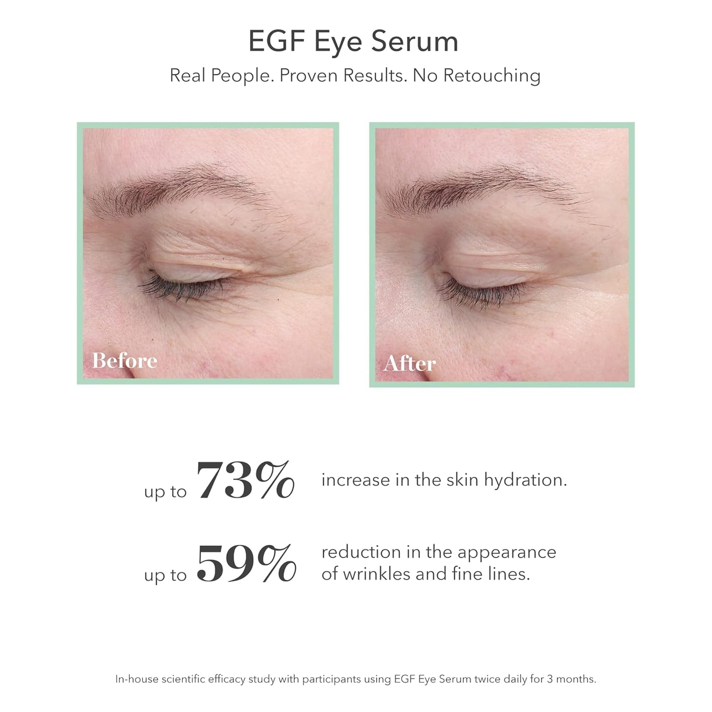 BIOEFFECT EGF Eye Serum Refill Set with Cooling Rollerball (6 ml) and One Refill Cartridge (6ml), Anti-Aging Corrective Gel with Hyaluronic Acid for Puffy Bags, Wrinkles, Fine Lines and Crows Feet