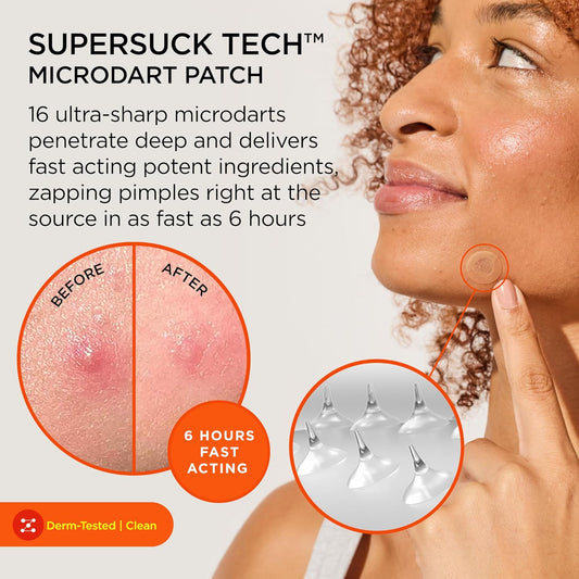 ZitSticka Killa Mini Acne Patches for Face - World's Most Potent Pimple Patch with Fast-Acting Microdarts - Starts Working within 2 Hours for Deep, Early-Stage Zits - 8 Count