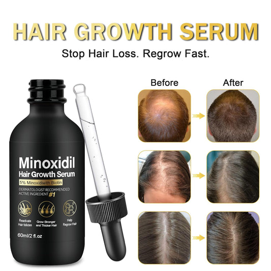 5% Minoxidil for Men and Women Hair Growth Treatment,Topical Minoxidil for Beard Growth, Hair Regrowth Serum for Scalp Hair Loss and Thinning, with Biotin (2 Fl Oz (Pack