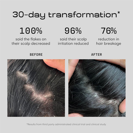 Jupiter Anti Dandruff Shampoo - Shampoo for Men & Women for Flaky, Itchy, Oily, & Dry Scalp - Nourishes Scalp and Reduces Breakage & Flakes - Color-Safe, Sulfate-Free, Paraben-Free