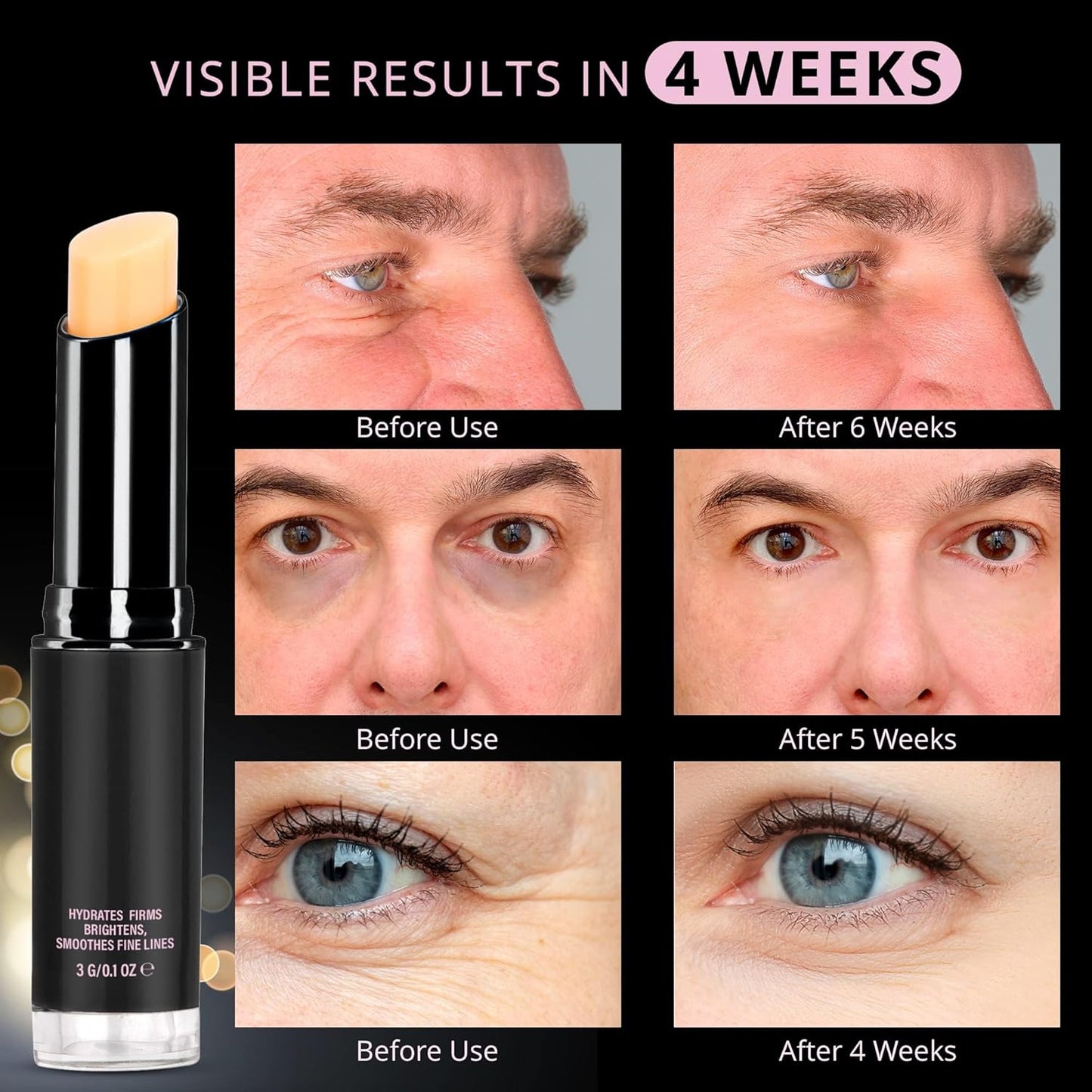 Retinol Eye Stick, Retinol Eye Cream for Dark Circles and Puffiness, Caffeine Eye Cream, Visible Results in 3-4 Weeks, Under Eye Cream Anti Aging