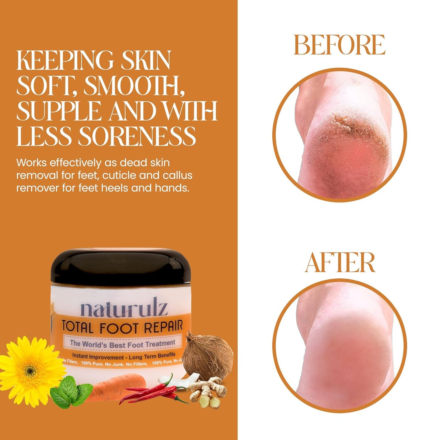 Naturulz Total Foot Repair 4oz – No Junk Foot Cream for Dry, Rough Skin & Cracked Heels, Lightweight & Compact Moisturizer for Feet, Knees, Elbows & Hands, Softens, Repairs & Smooths Cracked Skin