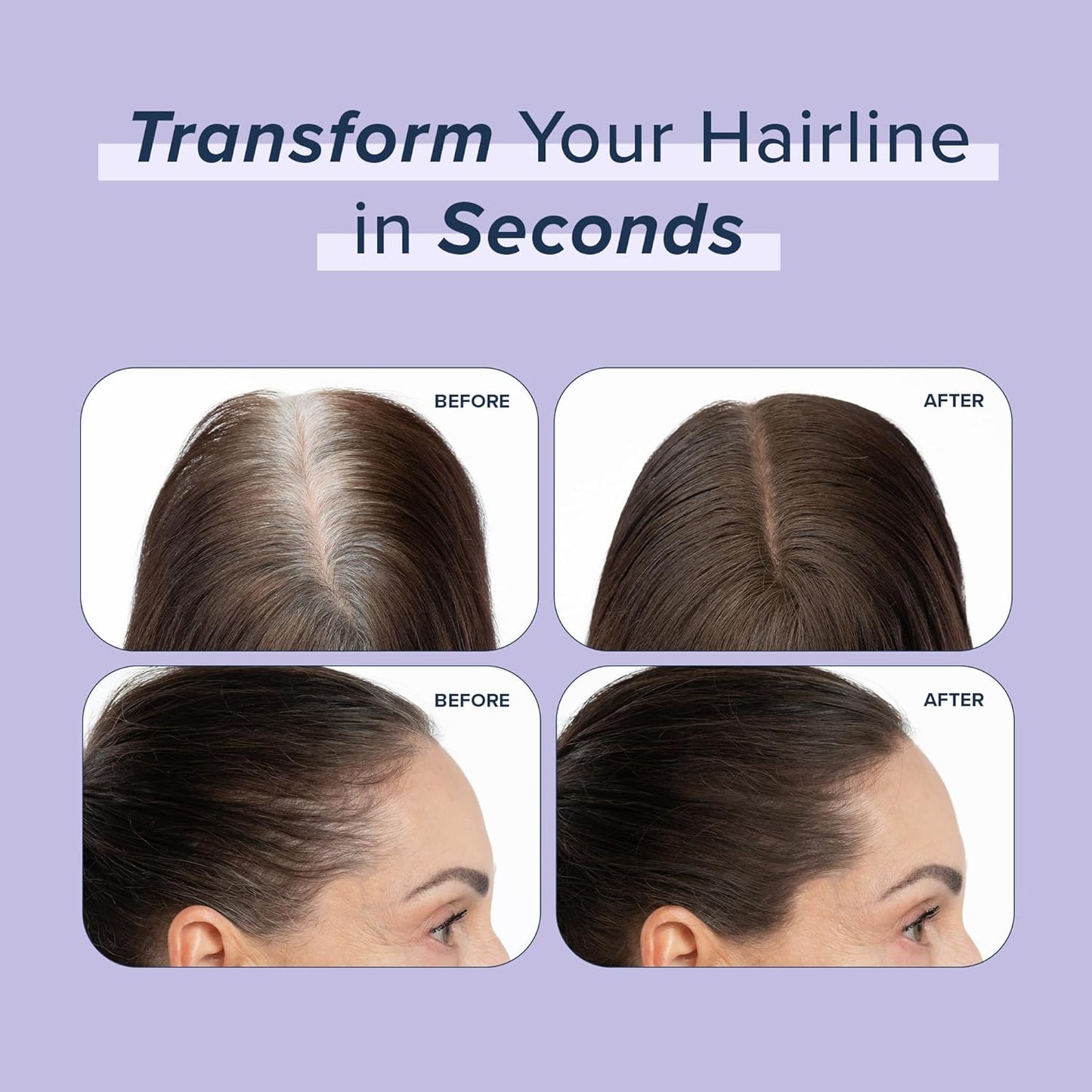 TRUHAIR Root & Scalp Cover Up Refill, Waterproof Pressed Powder for Gray Coverage, Bald Spots & Thinning Hair, Root Touch Up Color, 0.35 oz (Darkest Brown)