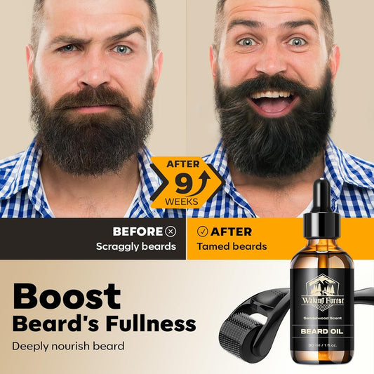Waking Forest Derma Roller 0.25mm & Beard Oil(1oz), Sandalwood Beard Kit, Microneedle Beard Roller with 540 Titanium, Natural Moisturize with Vitamin E Beard Oil for Men, Fathers Boyfriend Dad