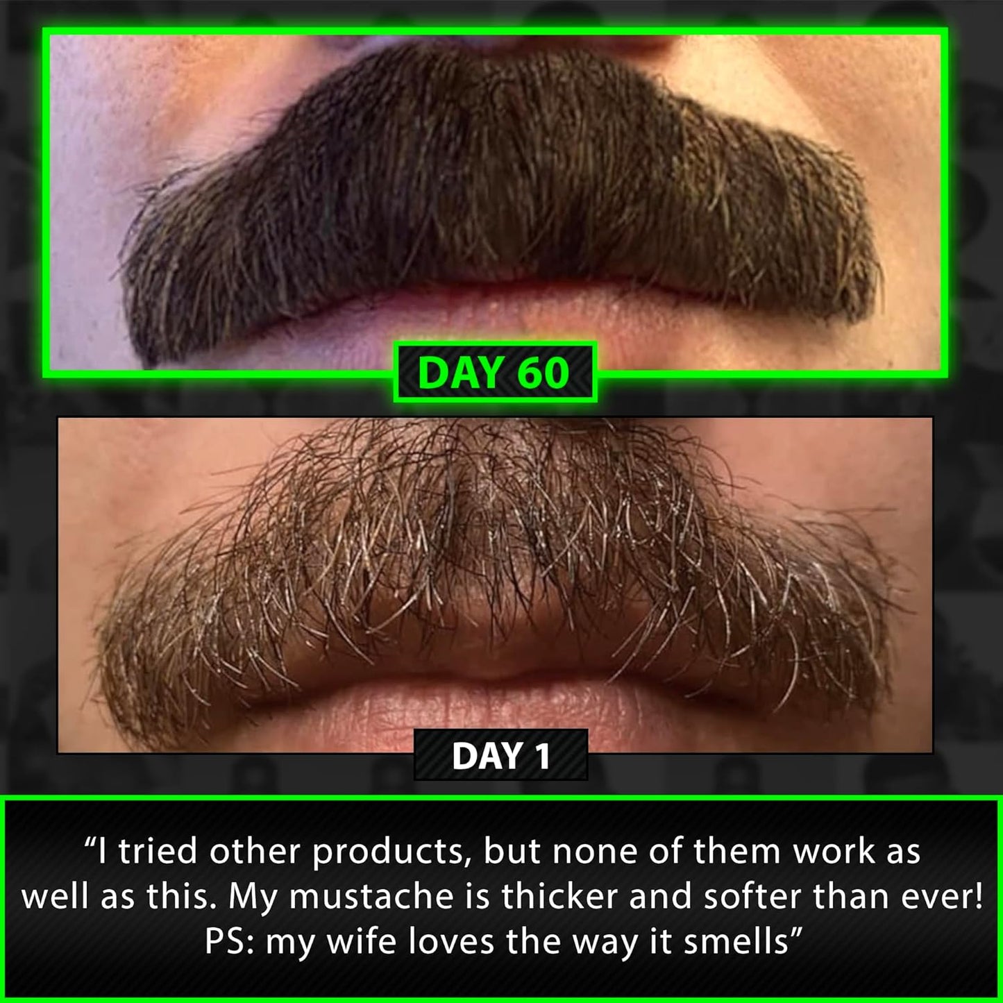 Beard Growth Kit w/GROW Beard Growth Oil for Men + 2X Thickening Biotin Beard Balm/Beard Care & Beard Conditioner (Beard Kit for Facial Hair Growth)