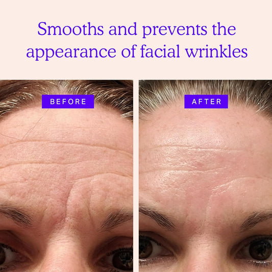BLUMBODY Face, Forehead Wrinkle Patches – Mini Anti-Wrinkle Facial Patches for Eyes, Mouth, Forehead – Triangle Non-Silicone Face Tape for Elevens, Crows Feet and Fine Lines – 160 Facial Patches