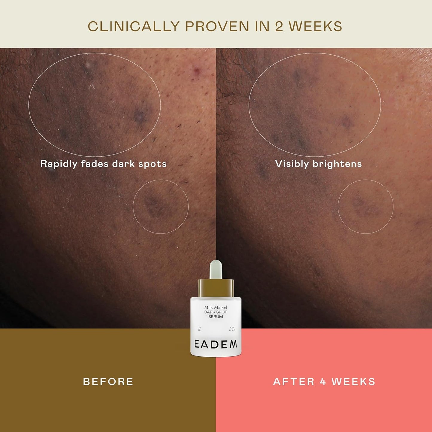 EADEM Milk Marvel Dark Spot Serum, Vitamin C Face Serum Infused with Niacinamide, Dark Spot Remover for Face and Body, Natural Dark Spot Corrector for Skin Care, 1 oz